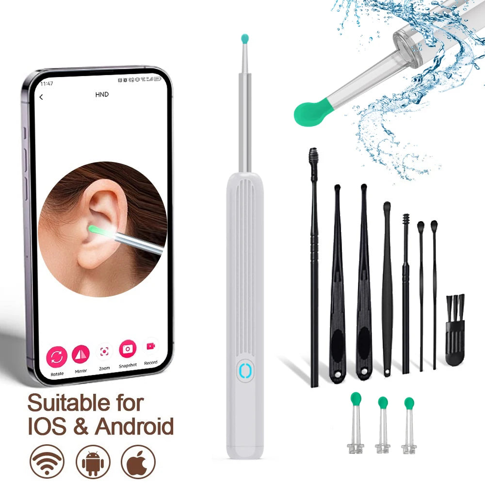 Revolutionize Your Ear Care with the Smart Visual HD Ear Cleaner - Wireless Otoscope for Effortless Wax Removal