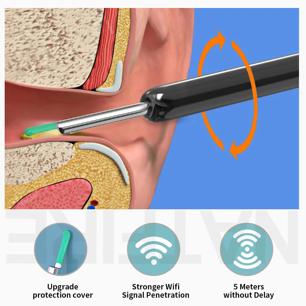 Revolutionize Your Ear Care with the Smart Visual HD Ear Cleaner - Wireless Otoscope for Effortless Wax Removal